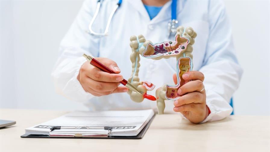 El c&aacute;ncer de colon es una enfermedad silenciosa que, muchas veces, puede prevenirse