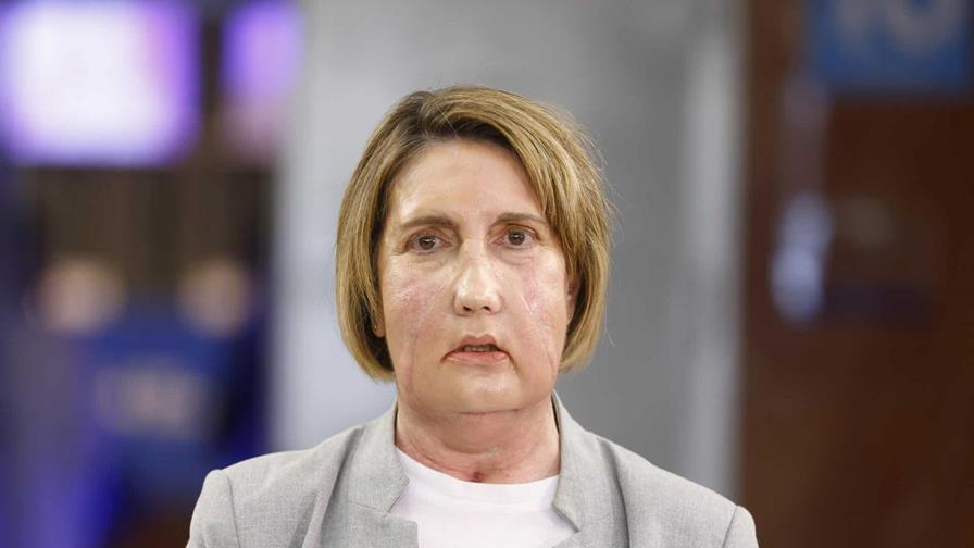 Barcelona hace el primer trasplante facial del mundo con donante que recibió la eutanasia Barcelona hace el primer trasplante facial del mundo con donante que recibió la eutanasia