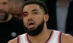 Towns recibe cortadura sobre su ojo derecho; Knicks vencen a Nuggets en doble tiempo extra