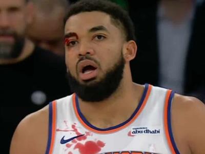 Towns, pese a herida en su ojo, aporta a triunfo de Knicks