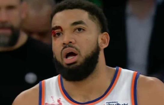 Towns recibe cortadura sobre su ojo derecho; Knicks vencen a Nuggets en doble tiempo extra
