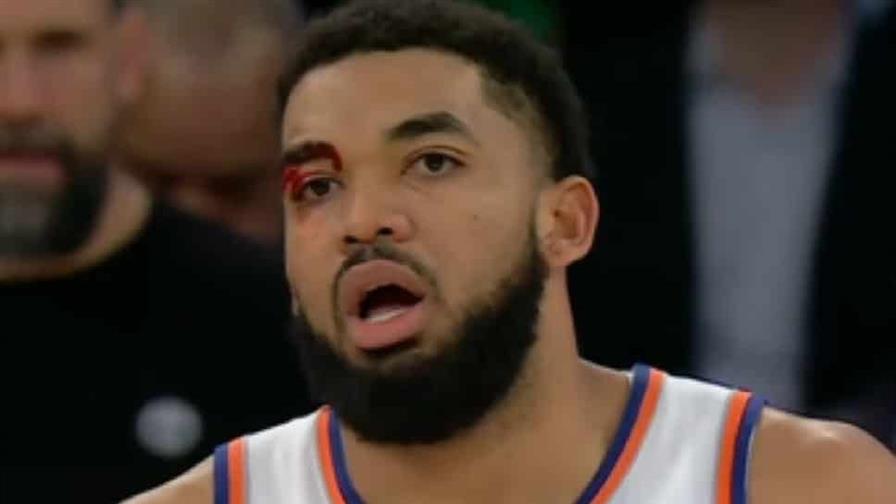 Towns recibe cortadura sobre su ojo derecho; Knicks vencen a Nuggets en doble tiempo extra
