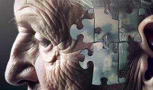 La estimulaci&oacute;n cognitiva precoz protege la memoria y la conectividad en el alzh&eacute;imer