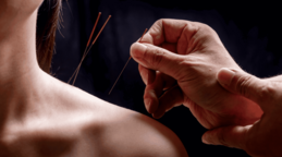 Dr. Jun Mao: "La acupuntura mejora el rendimiento cognitivo en supervivientes de c&aacute;ncer de mama"