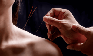 Dr. Jun Mao: "La acupuntura mejora el rendimiento cognitivo en supervivientes de c&aacute;ncer de mama"