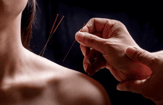 Dr. Jun Mao: "La acupuntura mejora el rendimiento cognitivo en supervivientes de c&aacute;ncer de mama"