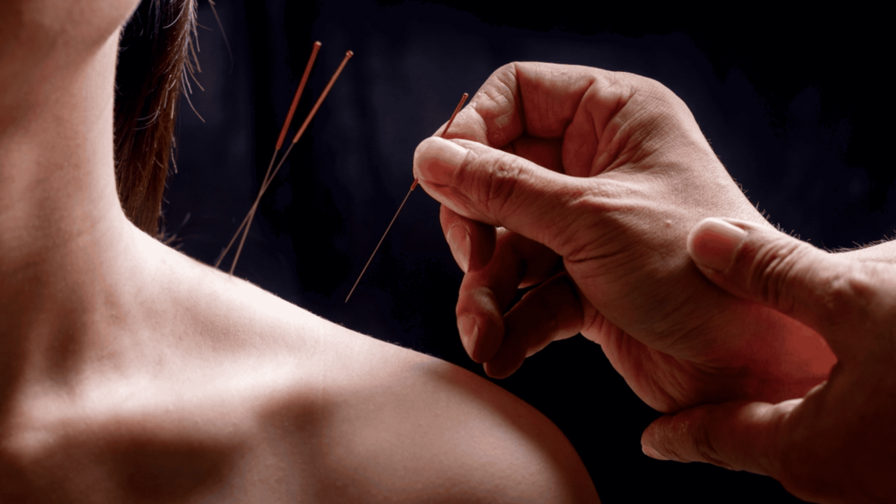 Dr. Jun Mao: "La acupuntura mejora el rendimiento cognitivo en supervivientes de c&aacute;ncer de mama"