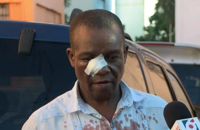 Maestro denuncia que fue atacado con sillas y piedras por dos estudiantes en Liceo Juan Pablo Duarte Maestro denuncia que fue atacado con sillas y piedras por dos estudiantes en Liceo Juan Pablo Duarte