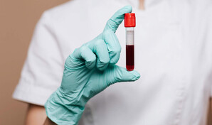 Unos biomarcadores en la sangre podr&iacute;an anticipar problemas de salud a corto plazo