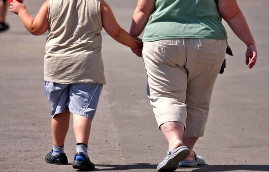 La obesidad afecta al sistema inmunitario incluso una d&eacute;cada despu&eacute;s de perder peso