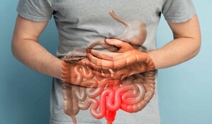 &iquest;Qu&eacute; significa un diagn&oacute;stico de enfermedad inflamatoria intestinal?
