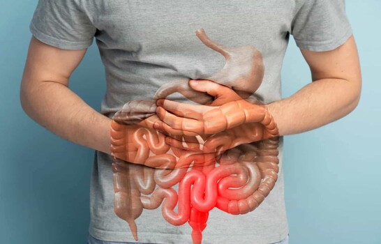 &iquest;Qu&eacute; significa un diagn&oacute;stico de enfermedad inflamatoria intestinal?