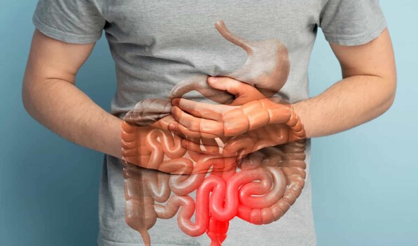 &iquest;Qu&eacute; significa un diagn&oacute;stico de enfermedad inflamatoria intestinal?