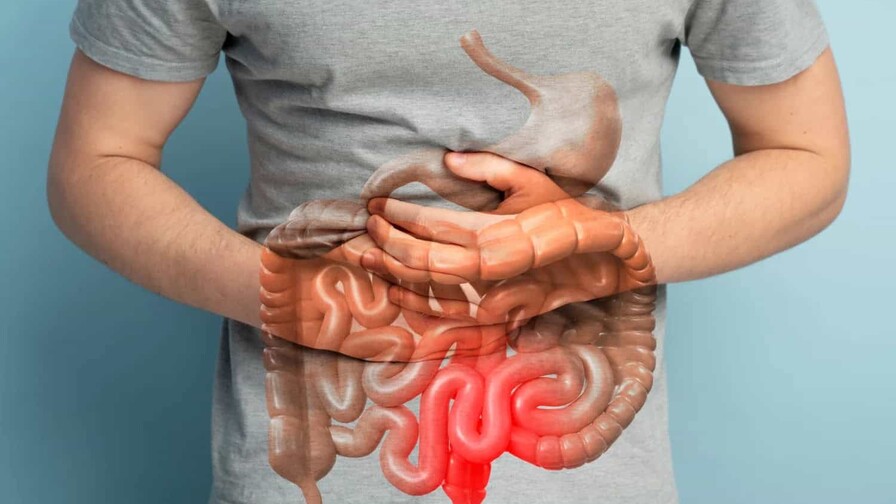 &iquest;Qu&eacute; significa un diagn&oacute;stico de enfermedad inflamatoria intestinal?