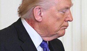 Trump es visto con una gran mancha roja en el cuello