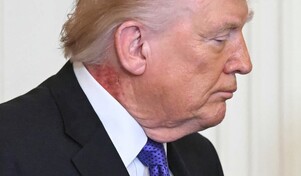 Trump es visto con una gran mancha roja en el cuello