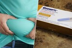 EE. UU. busca endurecer control de copias de tratamientos contra la obesidad EE. UU. busca endurecer control de copias de tratamientos contra la obesidad
