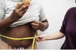 La obesidad continúa creciendo de forma silenciosa en RD, Dr. José A. García Pérez La obesidad continúa creciendo de forma silenciosa en RD, Dr. José A. García Pérez