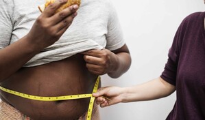 La obesidad contin&uacute;a creciendo de forma silenciosa en RD, Dr. Jos&eacute; A. Garc&iacute;a P&eacute;rez