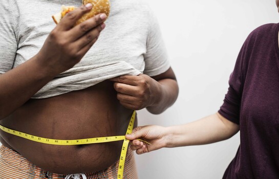 La obesidad contin&uacute;a creciendo de forma silenciosa en RD, Dr. Jos&eacute; A. Garc&iacute;a P&eacute;rez