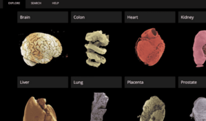 El google earth de los &oacute;rganos permite una perspectiva inigualable del cuerpo humano