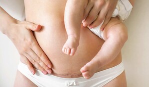 Posparto: se&ntilde;ales de alerta que no debes ignorar