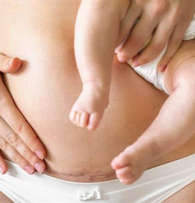 Posparto: se&ntilde;ales de alerta que no debes ignorar