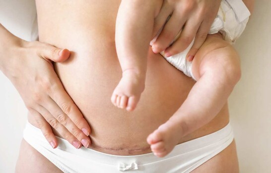 Posparto: se&ntilde;ales de alerta que no debes ignorar