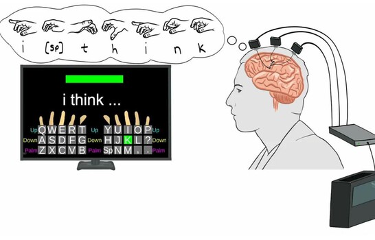 Una interfaz cerebro-computadora permite a dos personas con par&aacute;lisis comunicarse
