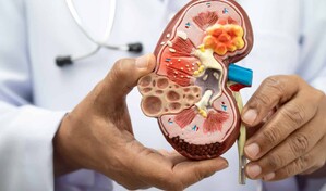 Nefr&oacute;loga de Cleveland Clinic asegura que chequeos m&eacute;dicos son claves para proteger salud renal