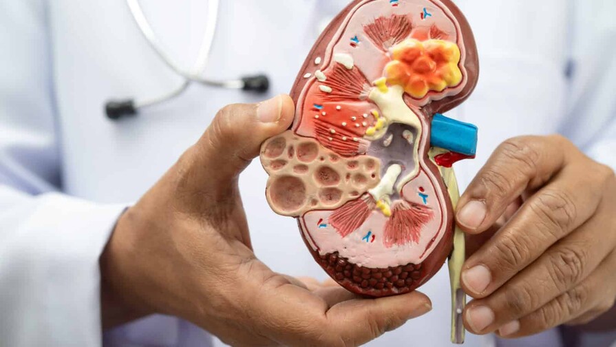Nefr&oacute;loga de Cleveland Clinic asegura que chequeos m&eacute;dicos son claves para proteger salud renal