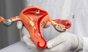 C&aacute;ncer de c&eacute;rvix sigue entre los m&aacute;s frecuentes en RD: 110 casos en el Incart en 2025