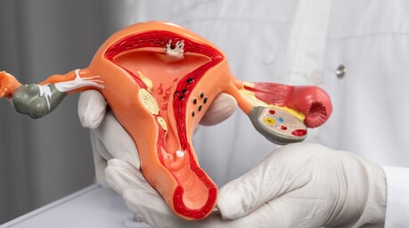 C&aacute;ncer de c&eacute;rvix sigue entre los m&aacute;s frecuentes en RD: 110 casos en el Incart en 2025