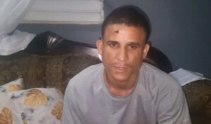Joven herido de bala en la cabeza en Santiago teme por su vida y narra c&oacute;mo ocurri&oacute; el ataque