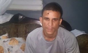 Joven herido de bala en la cabeza en Santiago teme por su vida y narra c&oacute;mo ocurri&oacute; el ataque