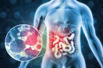 El 10 % de los diagnósticos de cáncer de colon se hacen antes del paciente cumplir 50 años El 10 % de los diagnósticos de cáncer de colon se hacen antes del paciente cumplir 50 años