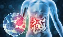 El 10 % de los diagn&oacute;sticos de c&aacute;ncer de colon se hacen antes del paciente cumplir 50 a&ntilde;os