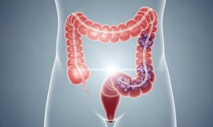 Salud P&uacute;blica llama a mayores de 45 a&ntilde;os a someterse a chequeos para prevenir el c&aacute;ncer de colon