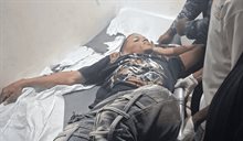 Joven resulta gravemente herido tras un choque en Dajab&oacute;n