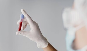 Un nuevo m&eacute;todo avanza hacia la detecci&oacute;n del c&aacute;ncer con un an&aacute;lisis de sangre