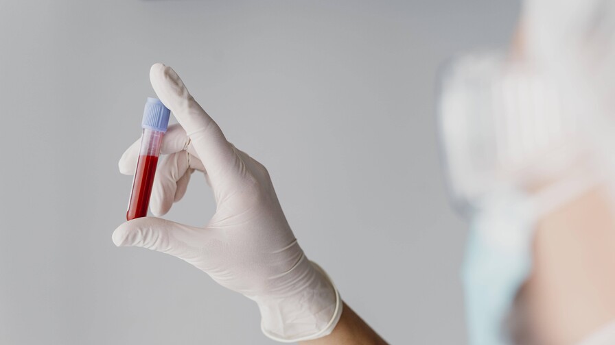 Un nuevo m&eacute;todo avanza hacia la detecci&oacute;n del c&aacute;ncer con un an&aacute;lisis de sangre