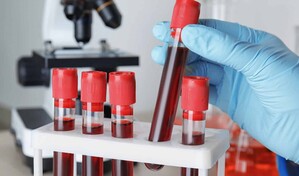 Caen los fallos por dopaje en ligas menores, pero la RD volvi&oacute; a liderar la lista