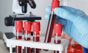 Caen los fallos por dopaje en ligas menores, pero la RD volvi&oacute; a liderar la lista