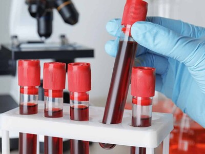 Caen los fallos por dopaje en ligas menores a sus mínimos