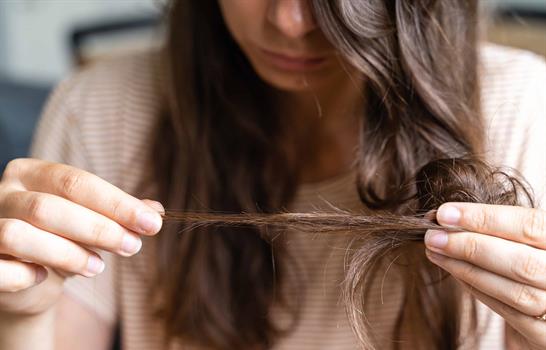 M&aacute;s all&aacute; de la ca&iacute;da: lo que debes saber sobre la calvicie femenina