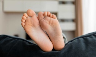 Amputaciones por pie diab&eacute;tico, una de las consecuencias graves de la enfermedad