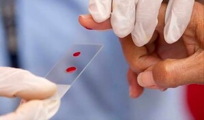 Estiman que m&aacute;s de 570 dominicanos viven con hemofilia