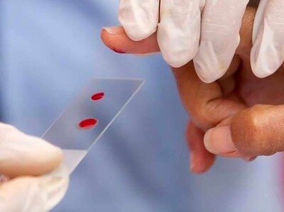 Hemofilia en República Dominicana supera 570 personas