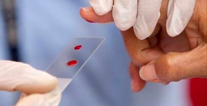 Estiman que m&aacute;s de 570 dominicanos viven con hemofilia