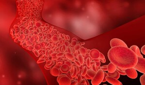 Colesterol, un factor silencioso que impacta la salud cardiovascular